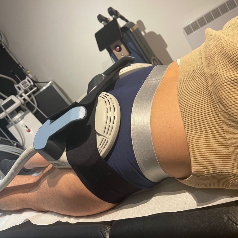 Séance musculation sans effort EMS Body Sculpt 15 tesla sur la zone fessier 30 minutes 40000 contractions chez Cryo M bien-être Le Mans