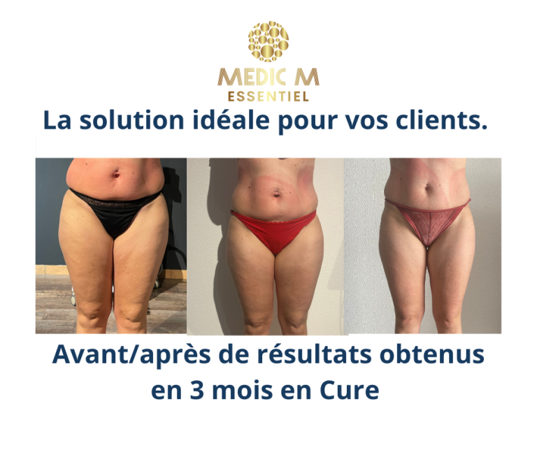 Avant-après d'une cliente Cryo M, appareils utilisé Body Shape, cryolipolyse vacuum et 8 plaques, Ems body sculpt 15 tesla