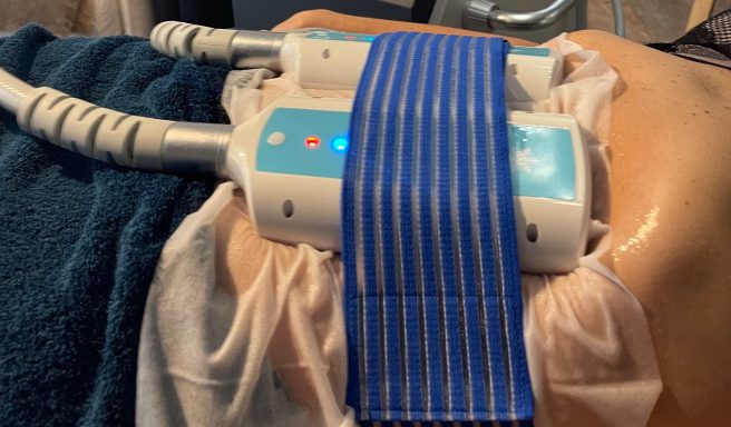 Cryolipolyse abdomen réduction graisse
