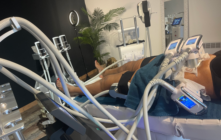cliente Cryo M lors d'une séance de cryolipolise vacuum abdomen et poignées d'amour combiné à une séance délectrostimulation sur les cuisses